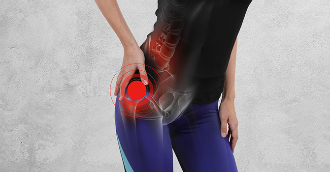 Fixing Your Hip With The McKenzie Method image