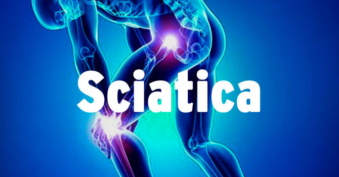 Pain In The Back Of My Leg(s) Is Sciatica…..Right? image