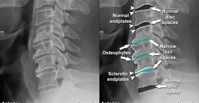 Does Your X-Ray/MRI Report Scare You? image