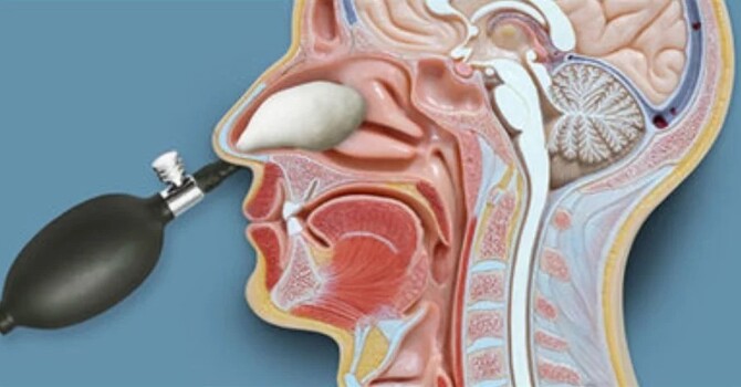 Nasal Release Technique image